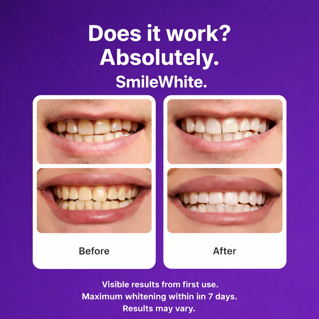 14STRIPS - SmileWhite Purple Teeth Whitening Strips
