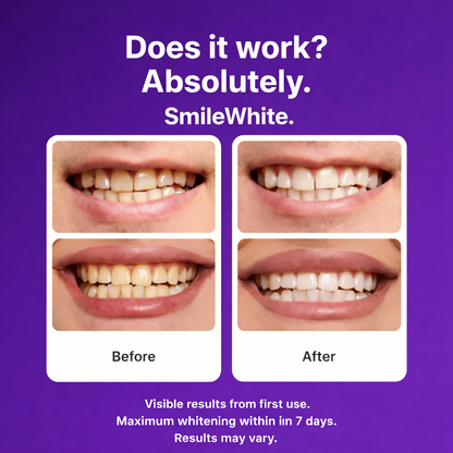 14STRIPS - SmileWhite Purple Teeth Whitening Strips
