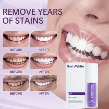 SmileWhite V34 Purple Color Correcting Toothpaste – Neutralize Yellow Stains